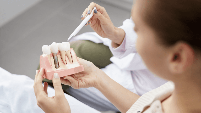 dental implant illustration